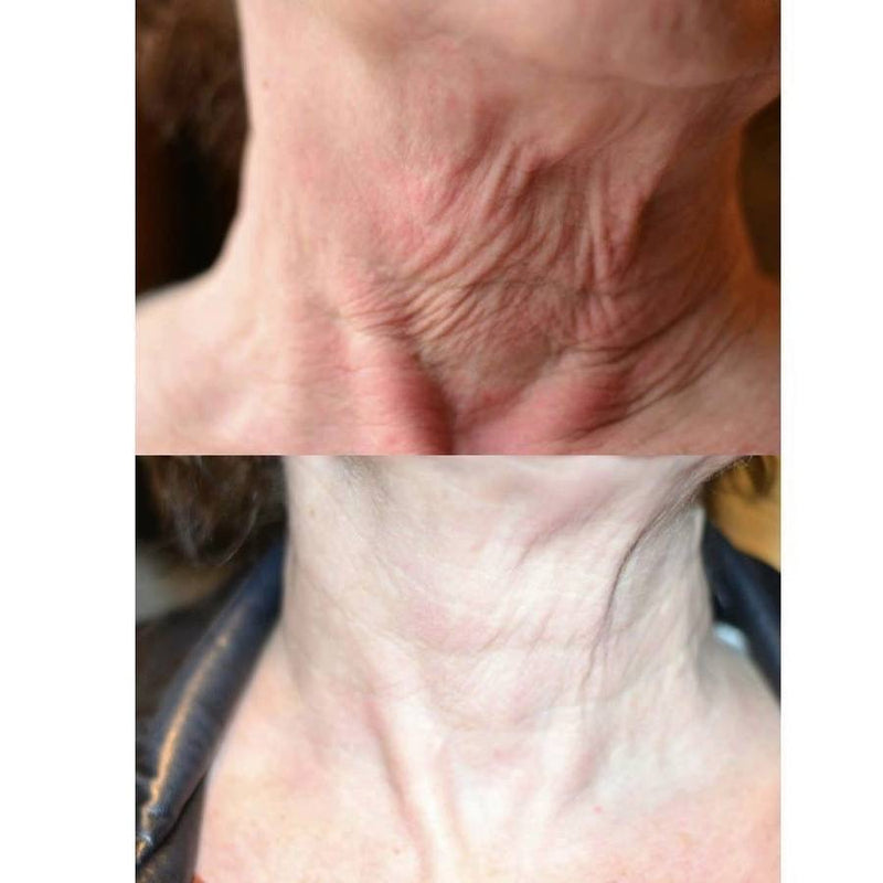 THE MAX STEM CELL NECK LIFT - CREMA COLLO E DECOLLETÈ