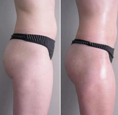 BIOSLIMMING CONTROL SHAPE