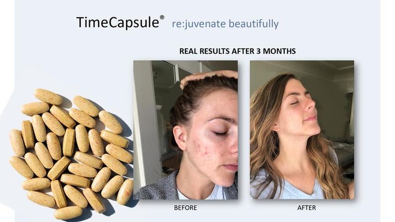 TIME CAPSULE, INTEGRATORE ALIMENTARE BASE DI COLLAGENE IDROLIZZATO PER LA BELLEZZA DELLA PELLE